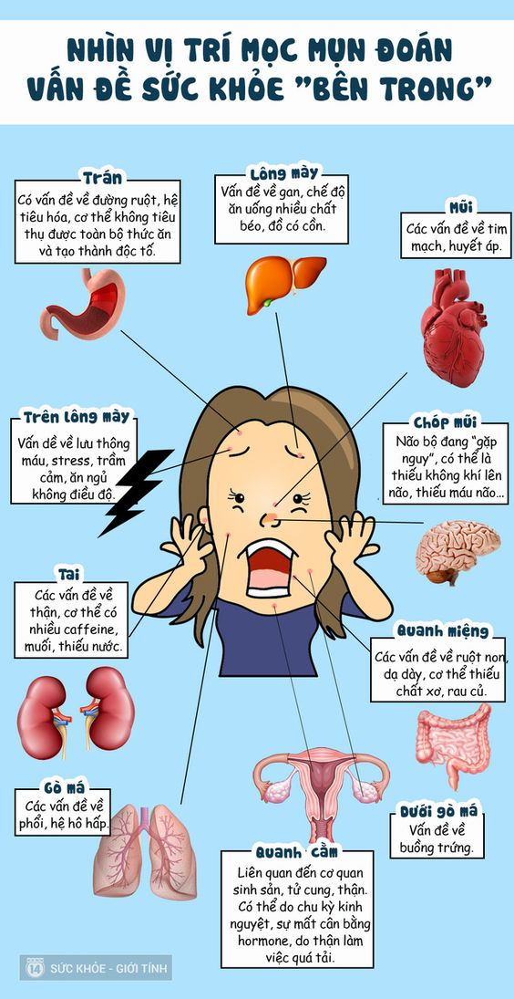 Dù bạn mọc mụn ở đâu, cũng có thể trị dứt điểm dễ dàng nhờ dùng đúng nguyên liệu - Ảnh 1.