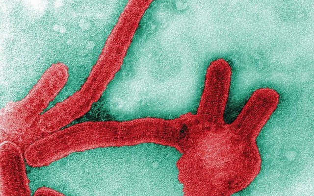 Những loại virus gây chết người kinh khủng nhất mọi thời đại