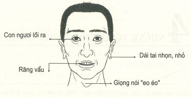 Xem tướng mặt người không biết giữ bí mật