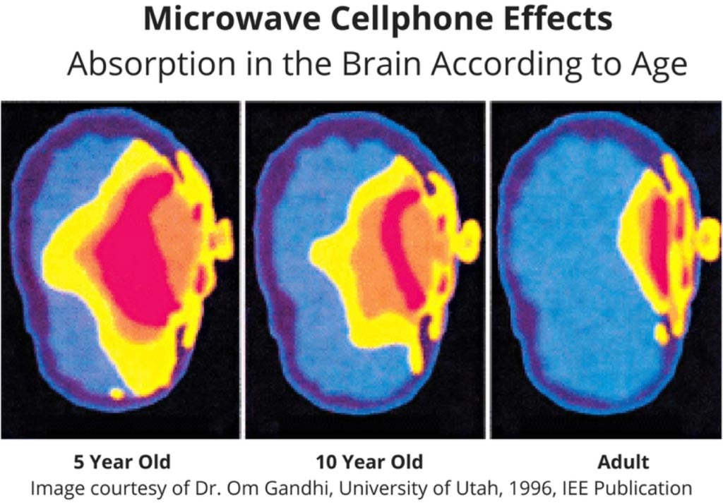 Sóng microwave ảnh hưởng đến não bộ