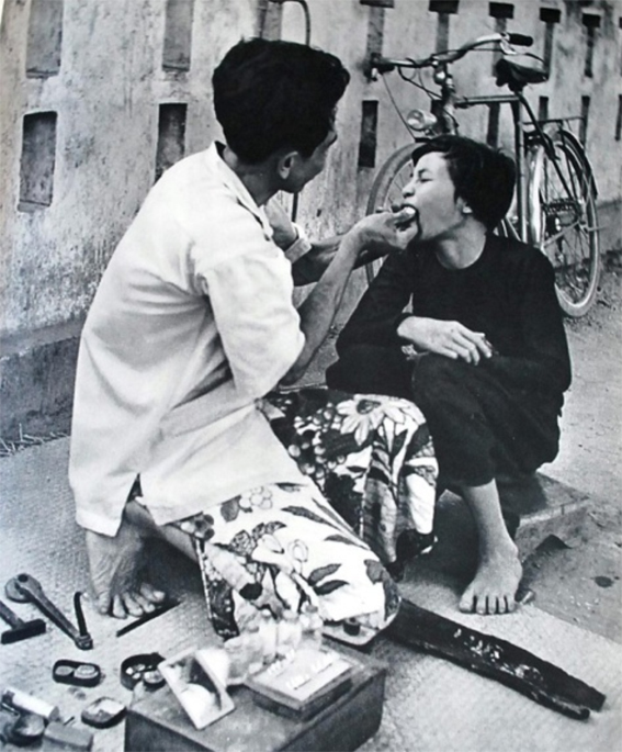 Tục nhuộm răng đen của người Việt